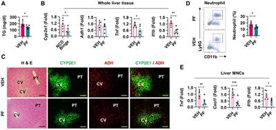 Psyllium fiber improves hangovers and inflammatory liver injury by inhibiting intestinal drinking